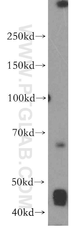Western Blot (WB) analysis of Jurkat cells using LRMP Polyclonal antibody (19498-1-AP)