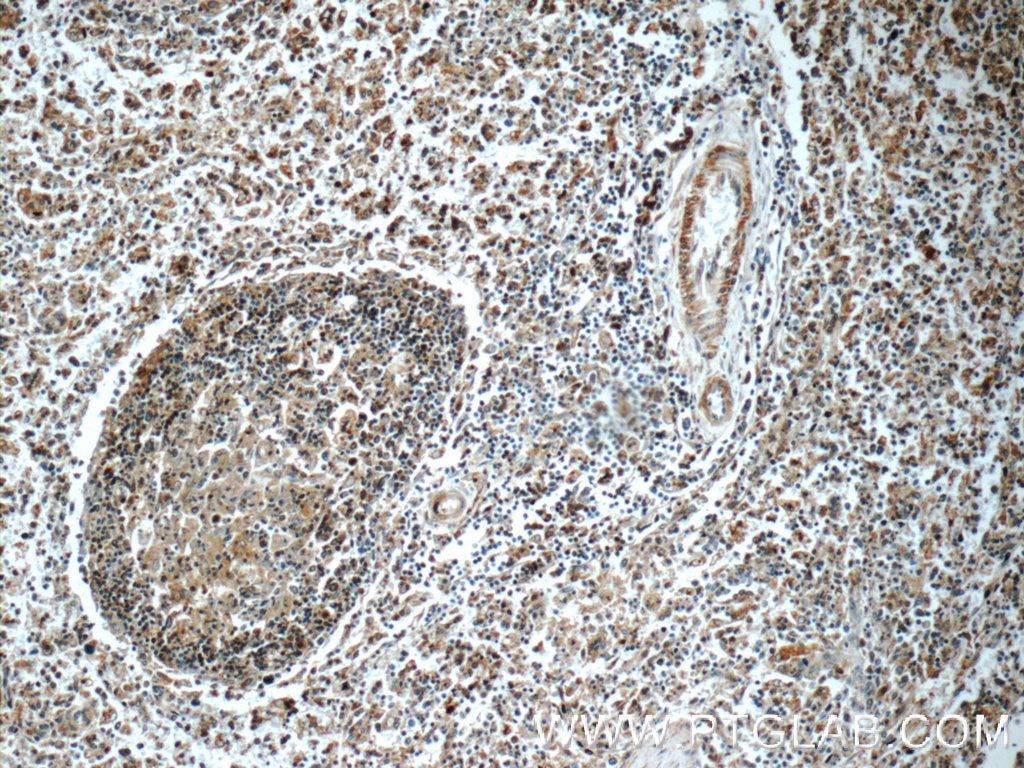 Immunohistochemistry (IHC) staining of human spleen tissue using LRMP Polyclonal antibody (24772-1-AP)