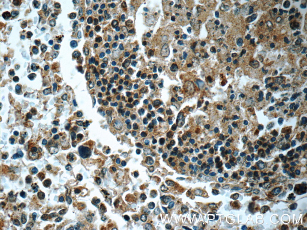 Immunohistochemistry (IHC) staining of human spleen tissue using LRMP Polyclonal antibody (24772-1-AP)
