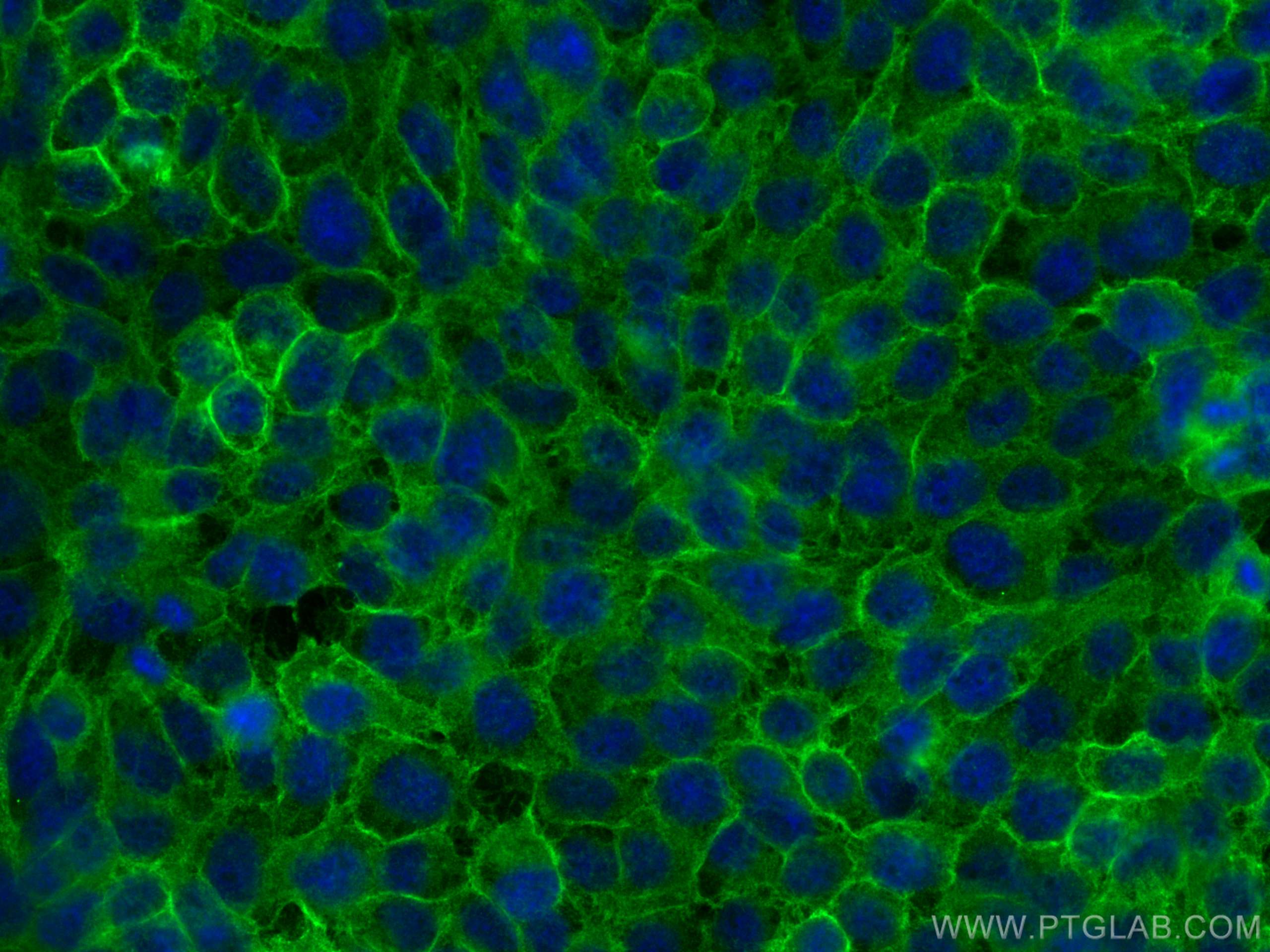 Immunofluorescence (IF) / fluorescent staining of A431 cells using PTPRA Polyclonal antibody (13079-1-AP)