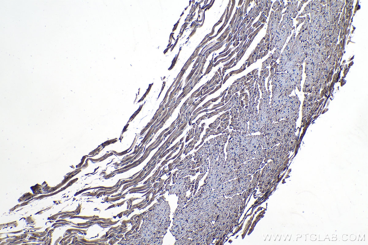 Immunohistochemistry (IHC) staining of mouse heart tissue using PTPRA Polyclonal antibody (13079-1-AP)