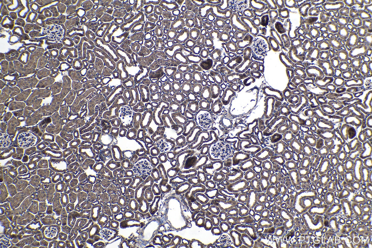Immunohistochemistry (IHC) staining of mouse kidney tissue using PTPRA Polyclonal antibody (13079-1-AP)