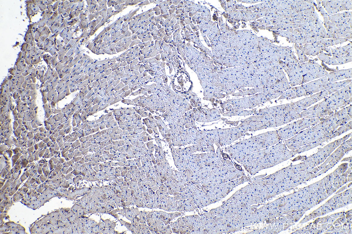 Immunohistochemistry (IHC) staining of rat heart tissue using PTPRA Polyclonal antibody (13079-1-AP)