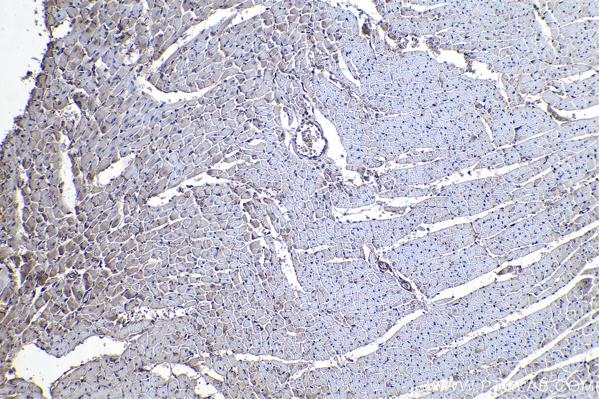 IHC staining of rat heart using 13079-1-AP