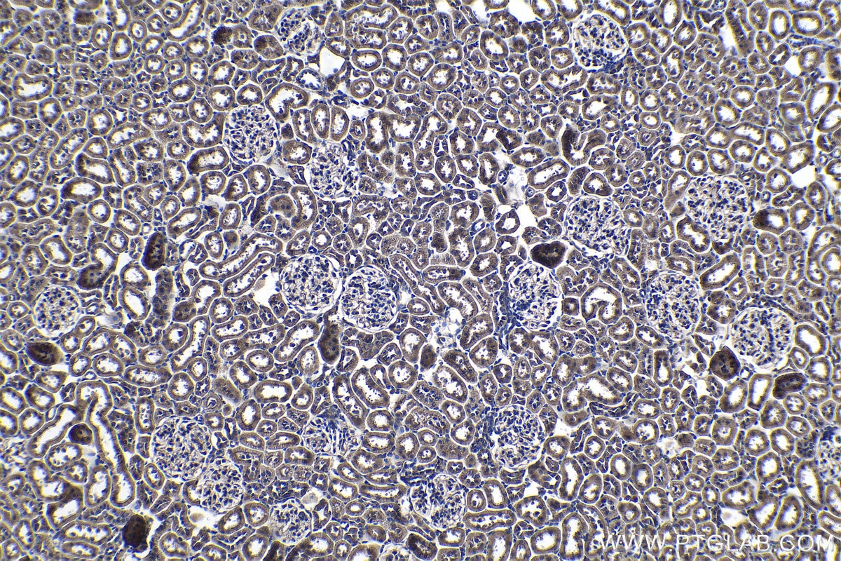 Immunohistochemistry (IHC) staining of rat kidney tissue using PTPRA Polyclonal antibody (13079-1-AP)