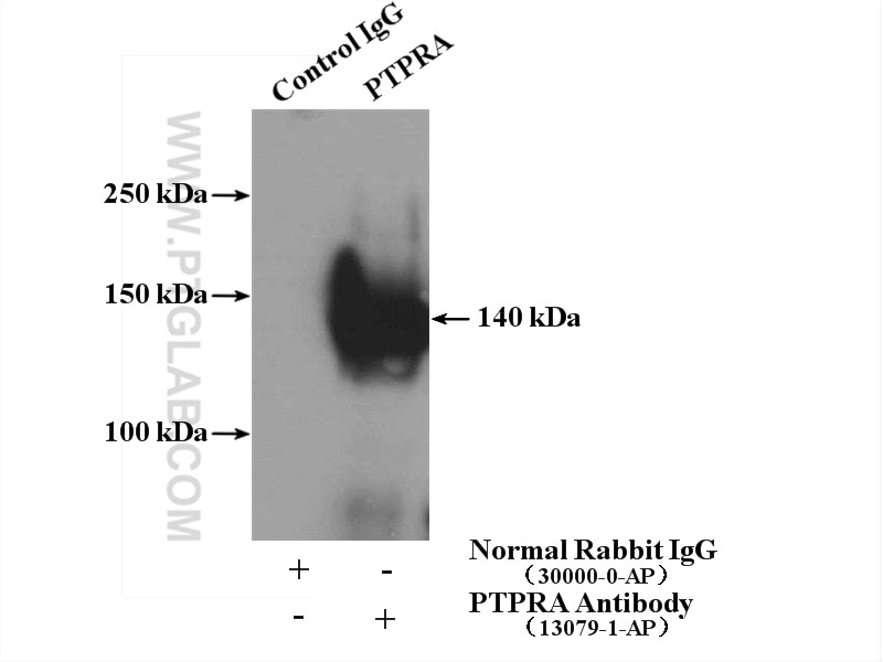 Immunoprecipitation (IP) experiment of A431 cells using PTPRA Polyclonal antibody (13079-1-AP)