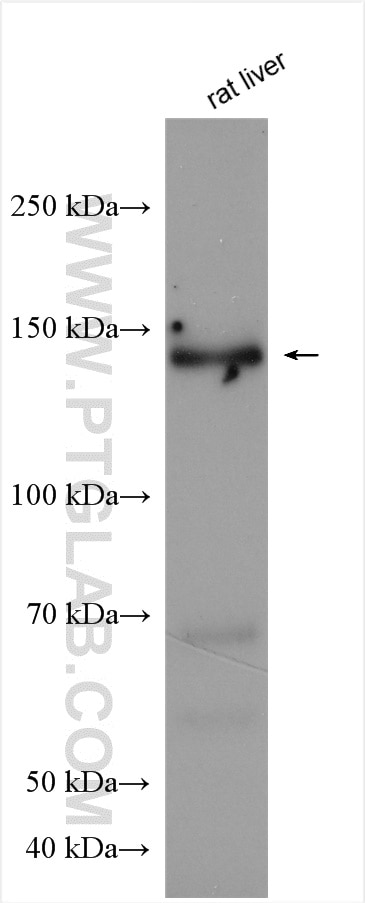 Western Blot (WB) analysis of rat liver tissue using PTPRA Polyclonal antibody (13079-1-AP)