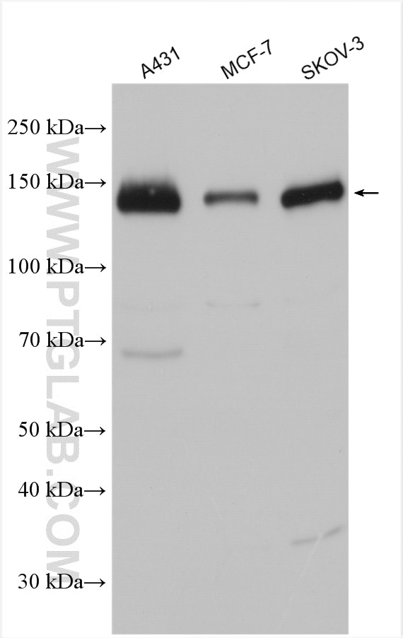 Western Blot (WB) analysis of various lysates using PTPRA Polyclonal antibody (13079-1-AP)