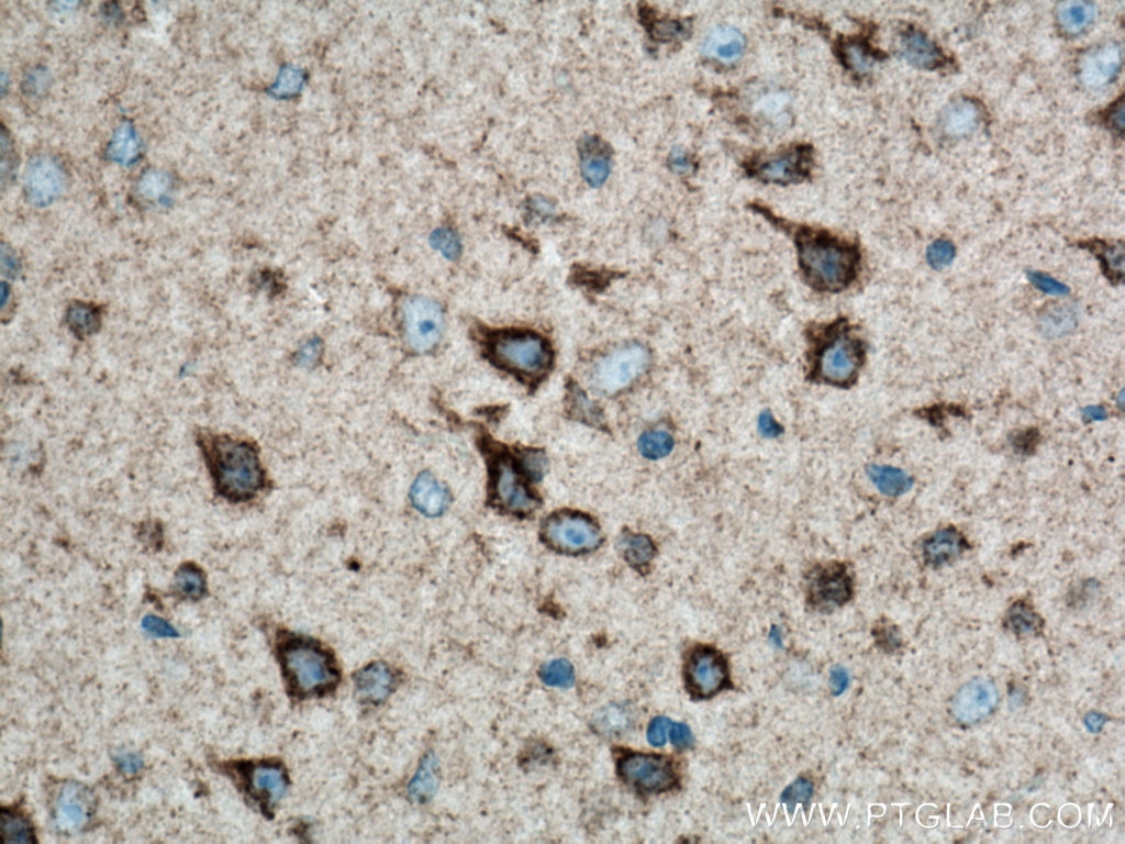 Immunohistochemistry (IHC) staining of mouse brain tissue using LRP1 Polyclonal antibody (26106-1-AP)