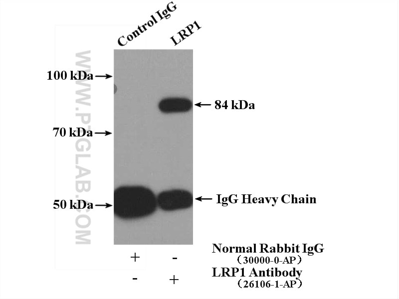 Immunoprecipitation (IP) experiment of mouse liver tissue using LRP1 Polyclonal antibody (26106-1-AP)
