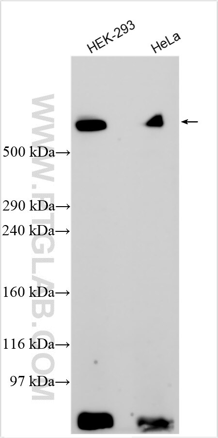 Western Blot (WB) analysis of various lysates using LRP1 Polyclonal antibody (30206-1-AP)