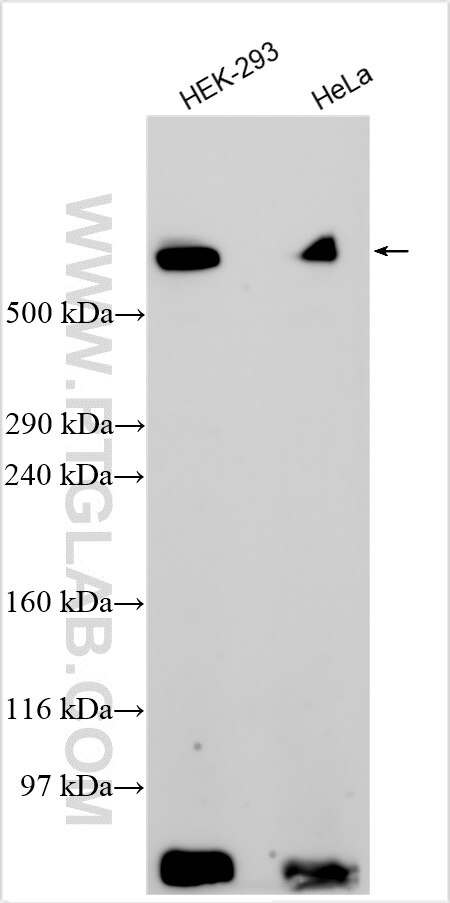 WB analysis using 30206-1-AP