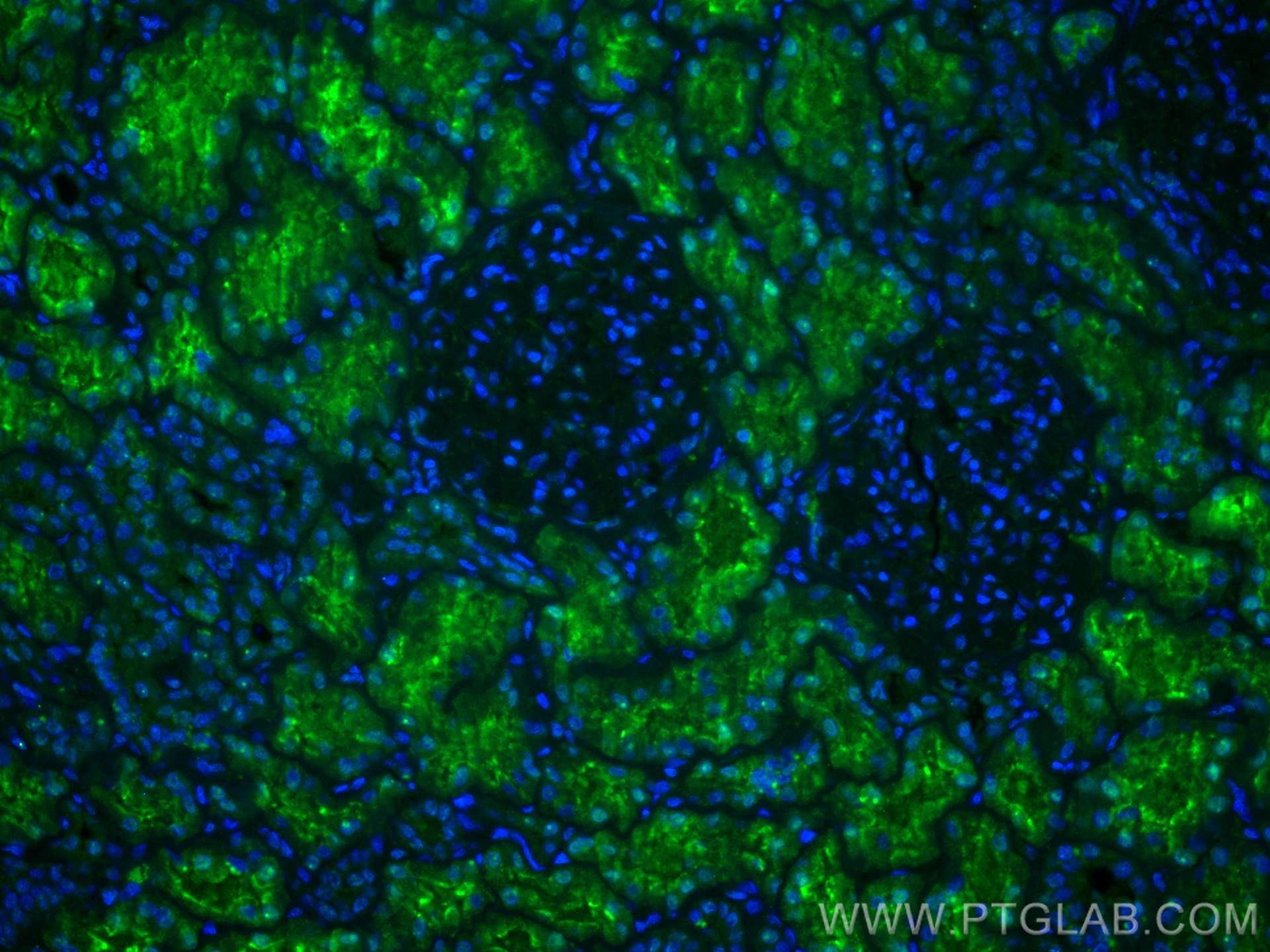Immunofluorescence (IF) / fluorescent staining of human kidney tissue using LRP2-Specific Polyclonal antibody (19700-1-AP)