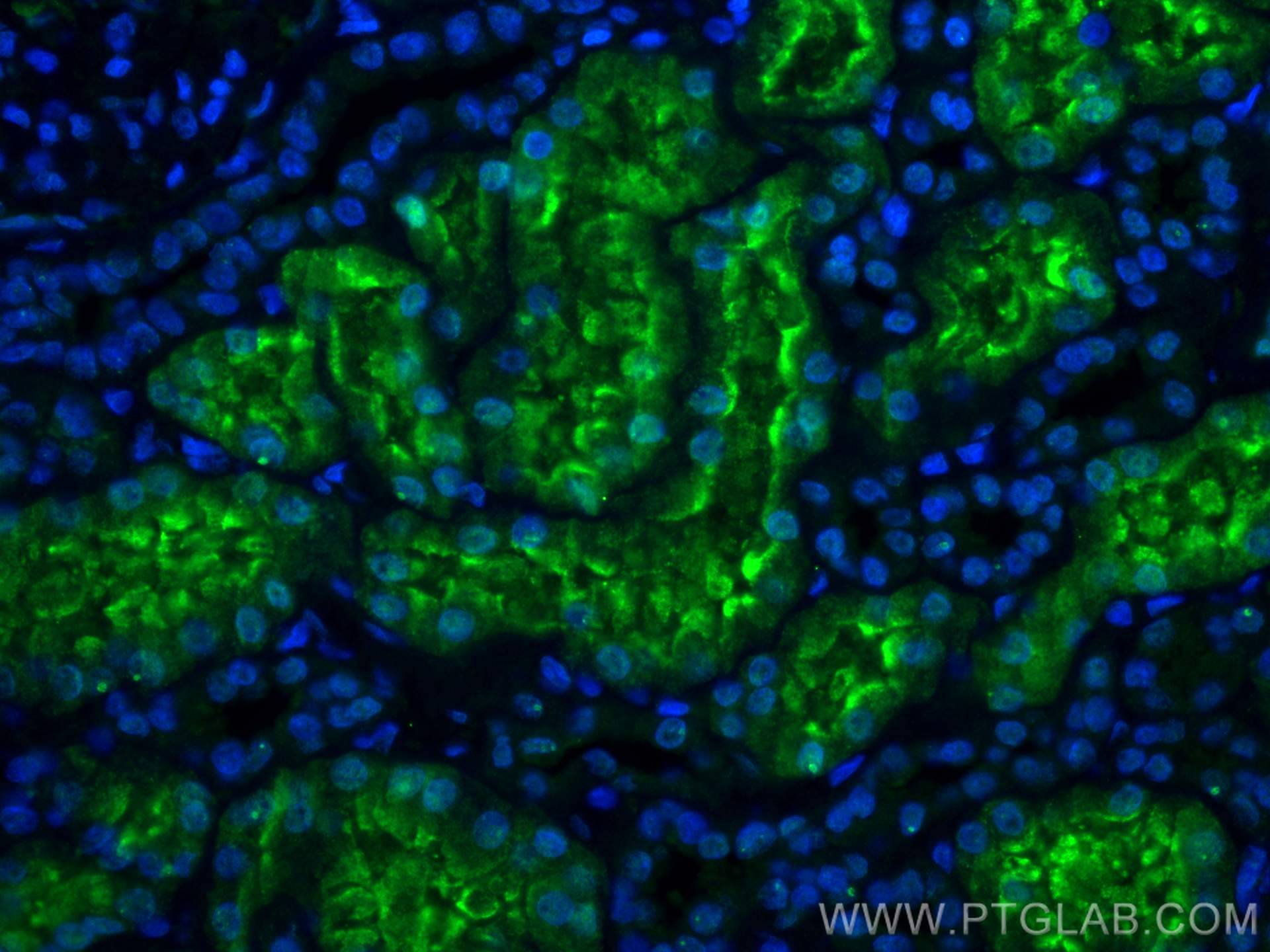 Immunofluorescence (IF) / fluorescent staining of human kidney tissue using LRP2-Specific Polyclonal antibody (19700-1-AP)