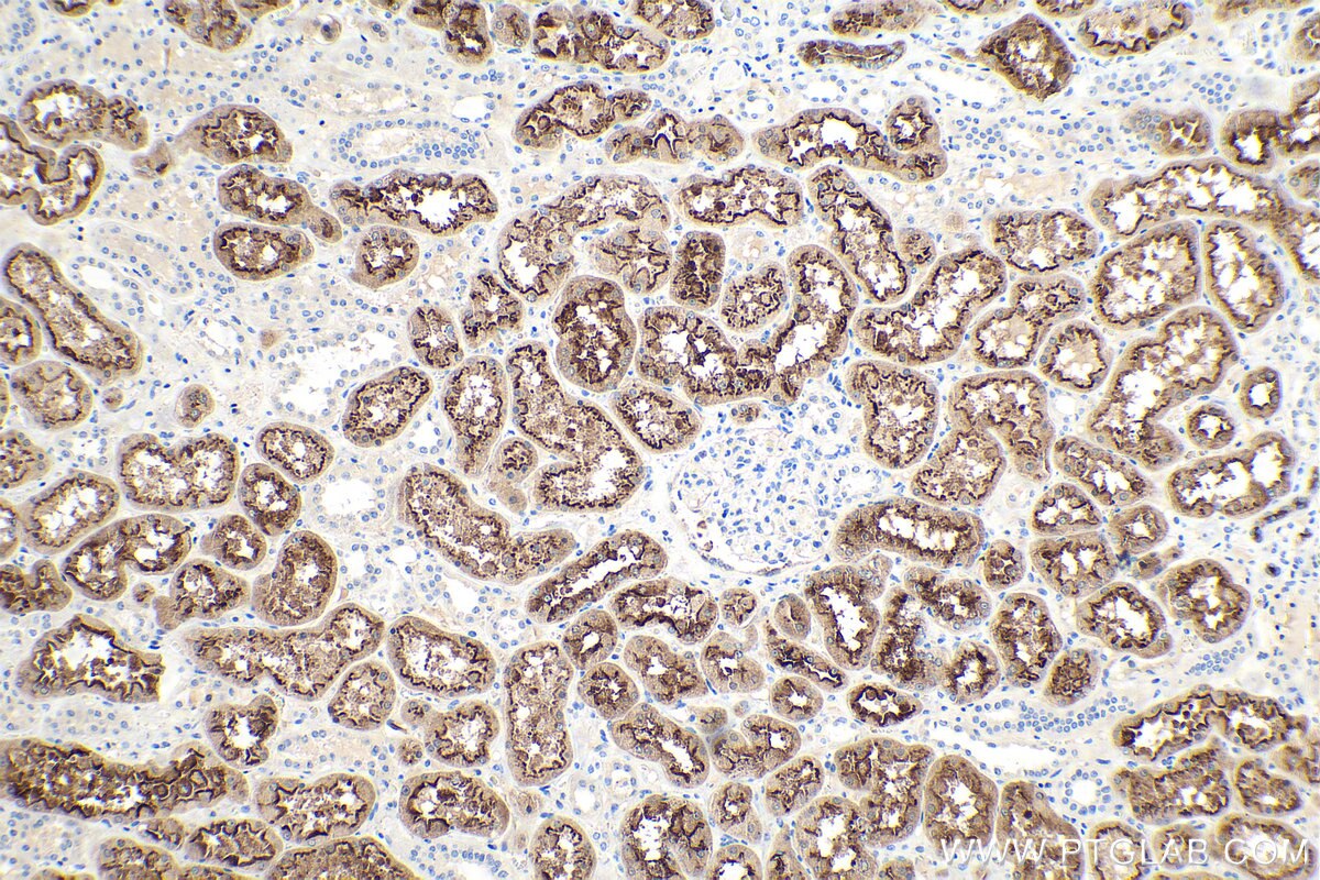 Immunohistochemistry (IHC) staining of human kidney tissue using LRP2-Specific Polyclonal antibody (19700-1-AP)