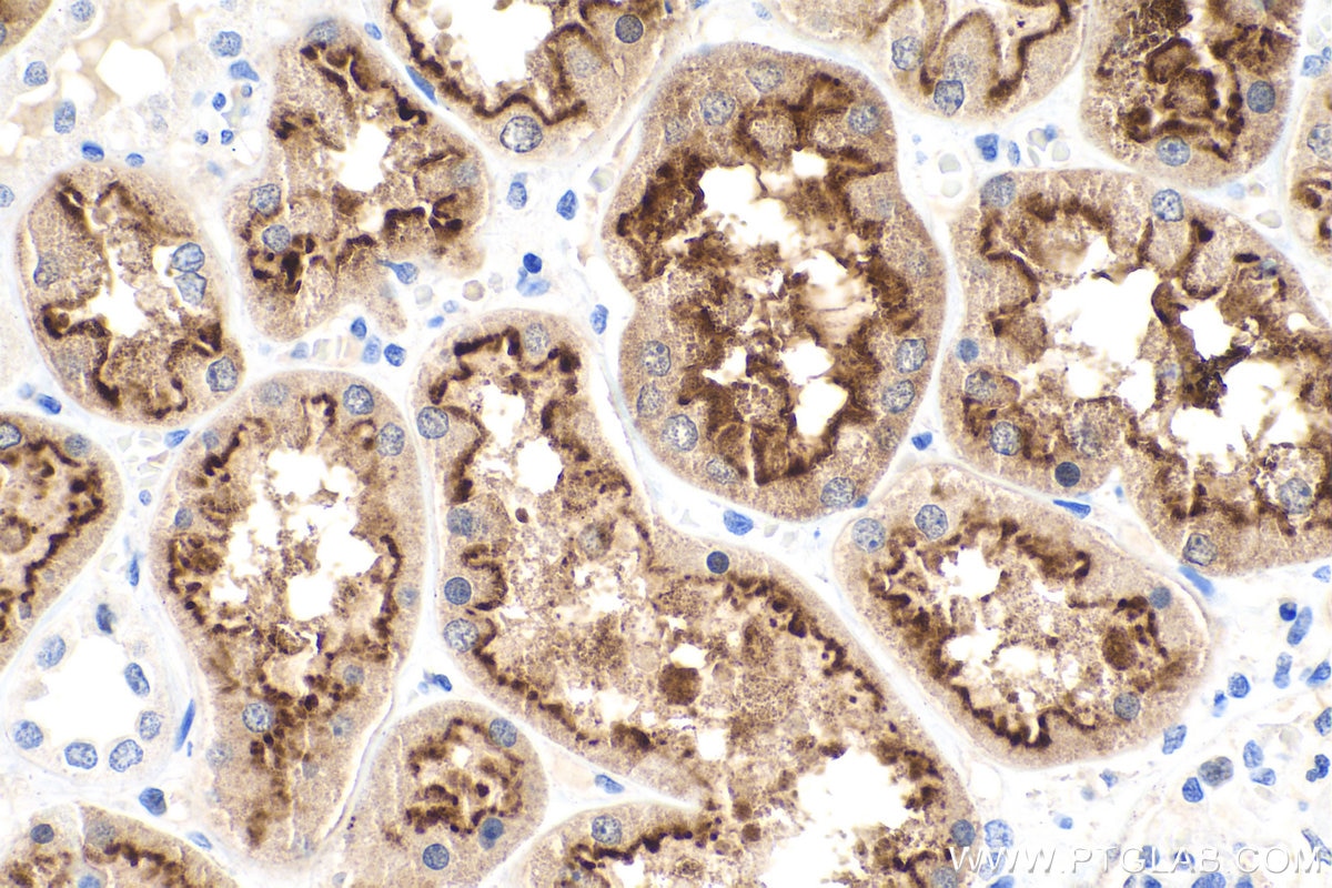 Immunohistochemistry (IHC) staining of human kidney tissue using LRP2-Specific Polyclonal antibody (19700-1-AP)