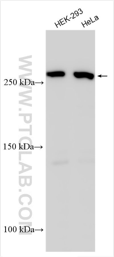 Western Blot (WB) analysis of various lysates using LRP2-Specific Polyclonal antibody (19700-1-AP)