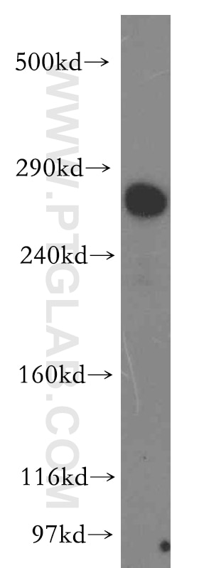 Western Blot (WB) analysis of HEK-293 cells using LRP2-Specific Polyclonal antibody (19700-1-AP)