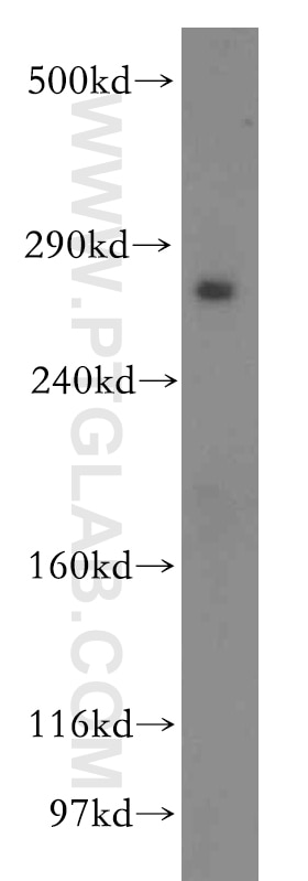 Western Blot (WB) analysis of human placenta tissue using LRP2-Specific Polyclonal antibody (19700-1-AP)