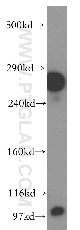 Western Blot (WB) analysis of human brain tissue using LRP2-Specific Polyclonal antibody (19700-1-AP)