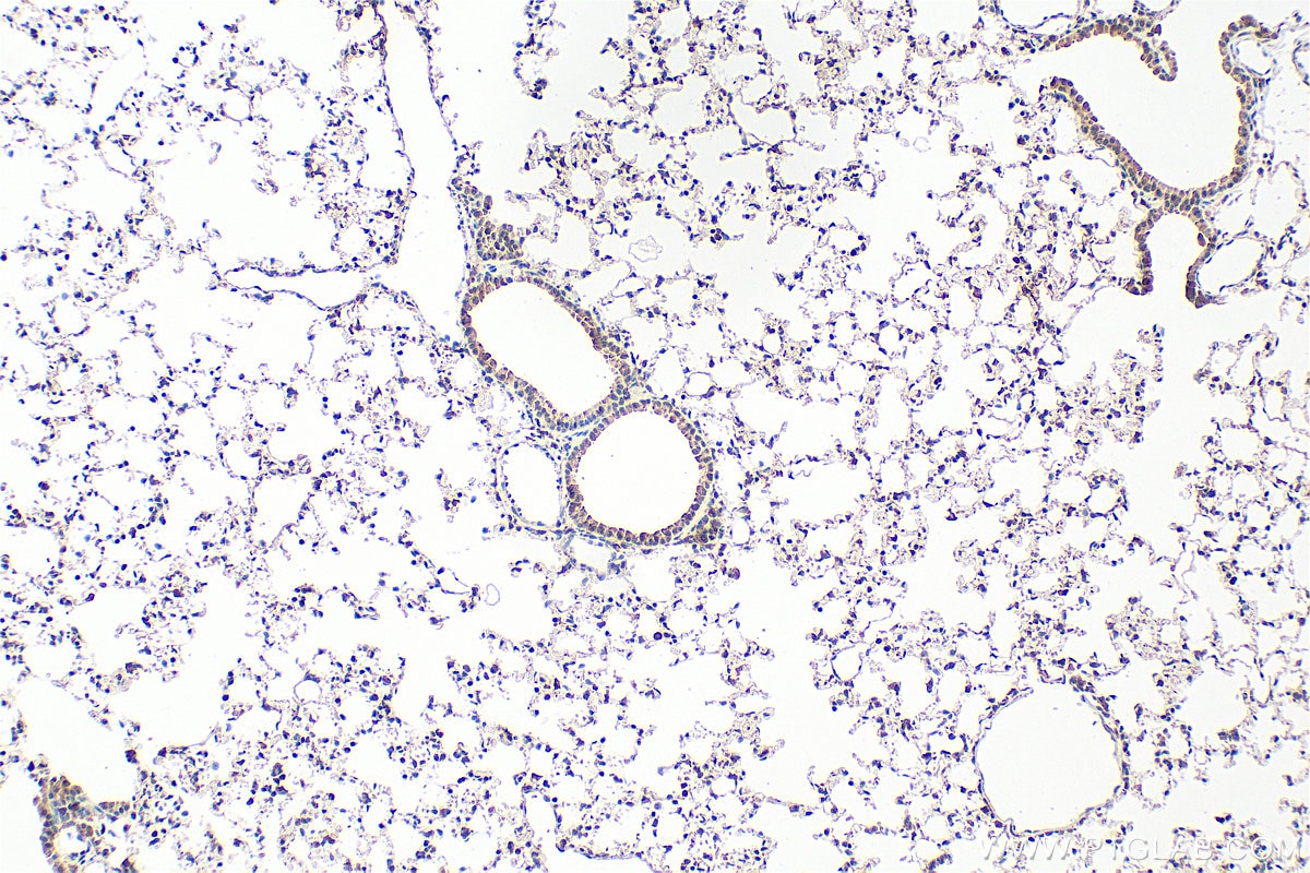 Immunohistochemistry (IHC) staining of mouse lung tissue using LRP2BP Polyclonal antibody (25783-1-AP)
