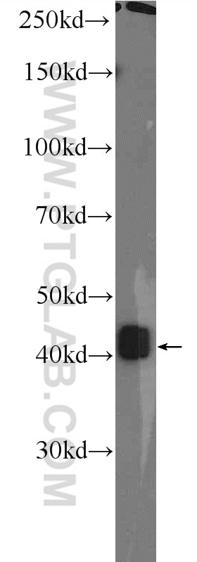 Western Blot (WB) analysis of Jurkat cells using LRP2BP Polyclonal antibody (25783-1-AP)