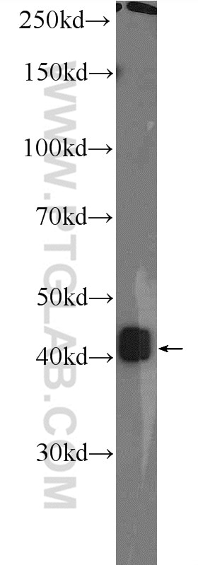 WB analysis of Jurkat using 25783-1-AP