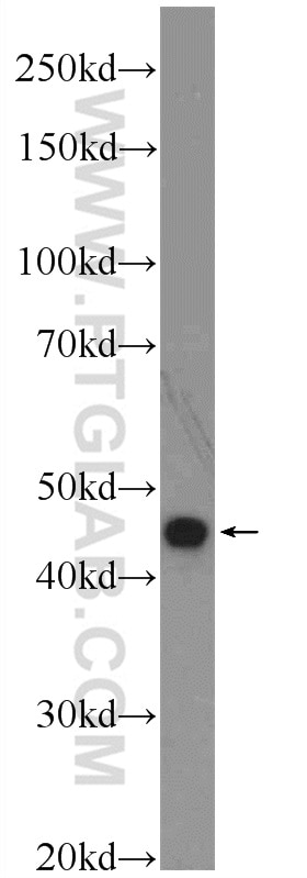 Western Blot (WB) analysis of A549 cells using LRP2BP Polyclonal antibody (25783-1-AP)