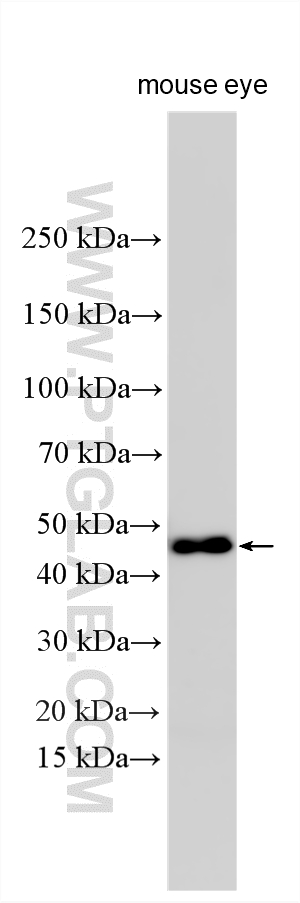 Western Blot (WB) analysis of various lysates using LRP2BP Polyclonal antibody (25783-1-AP)