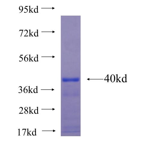 LRP2BP fusion protein Ag22779 SDS-PAGE