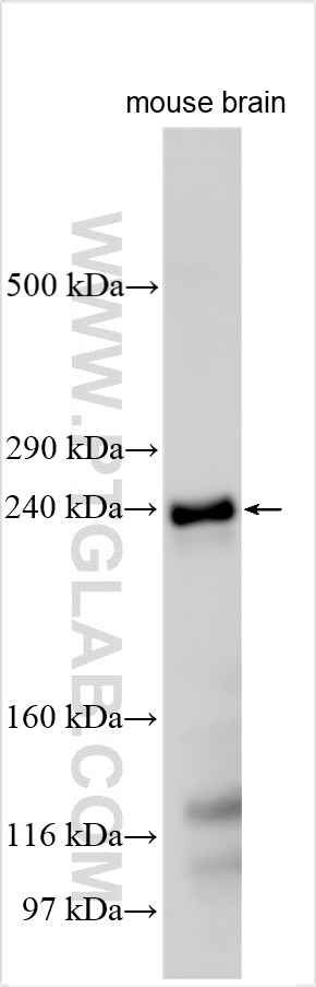 Western Blot (WB) analysis of various lysates using LRP4 Polyclonal antibody (24434-1-AP)