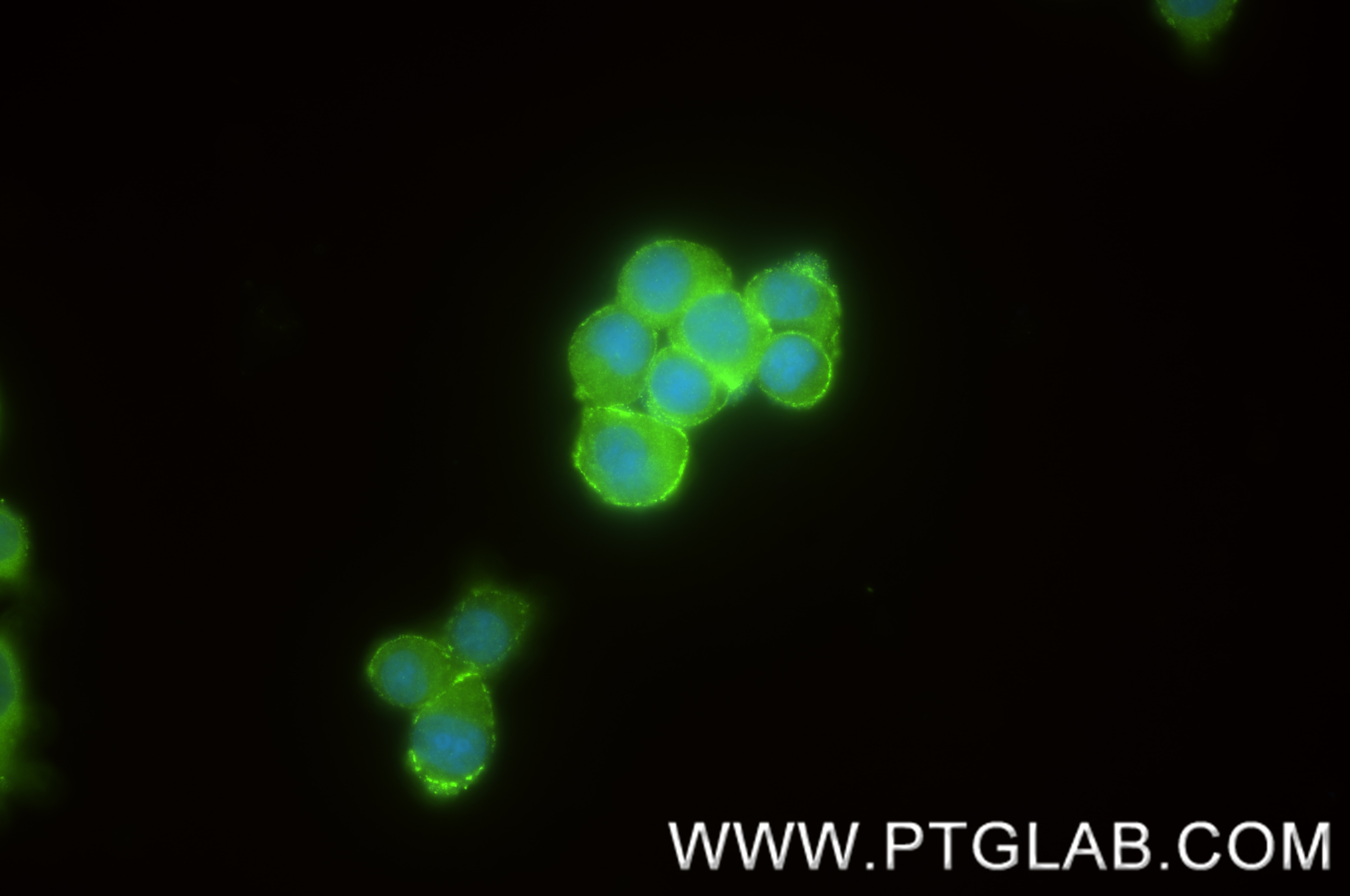 Immunofluorescence (IF) / fluorescent staining of PC-12 cells using LRP4 Recombinant antibody (84973-1-RR)