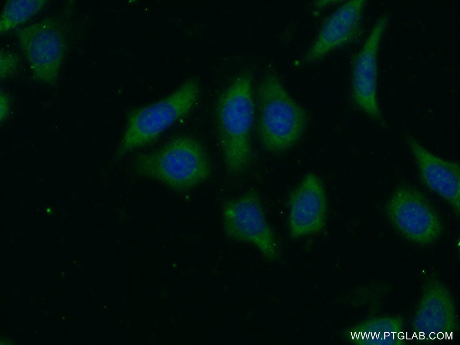 Immunofluorescence (IF) / fluorescent staining of HeLa cells using LRP5 Polyclonal antibody (24899-1-AP)