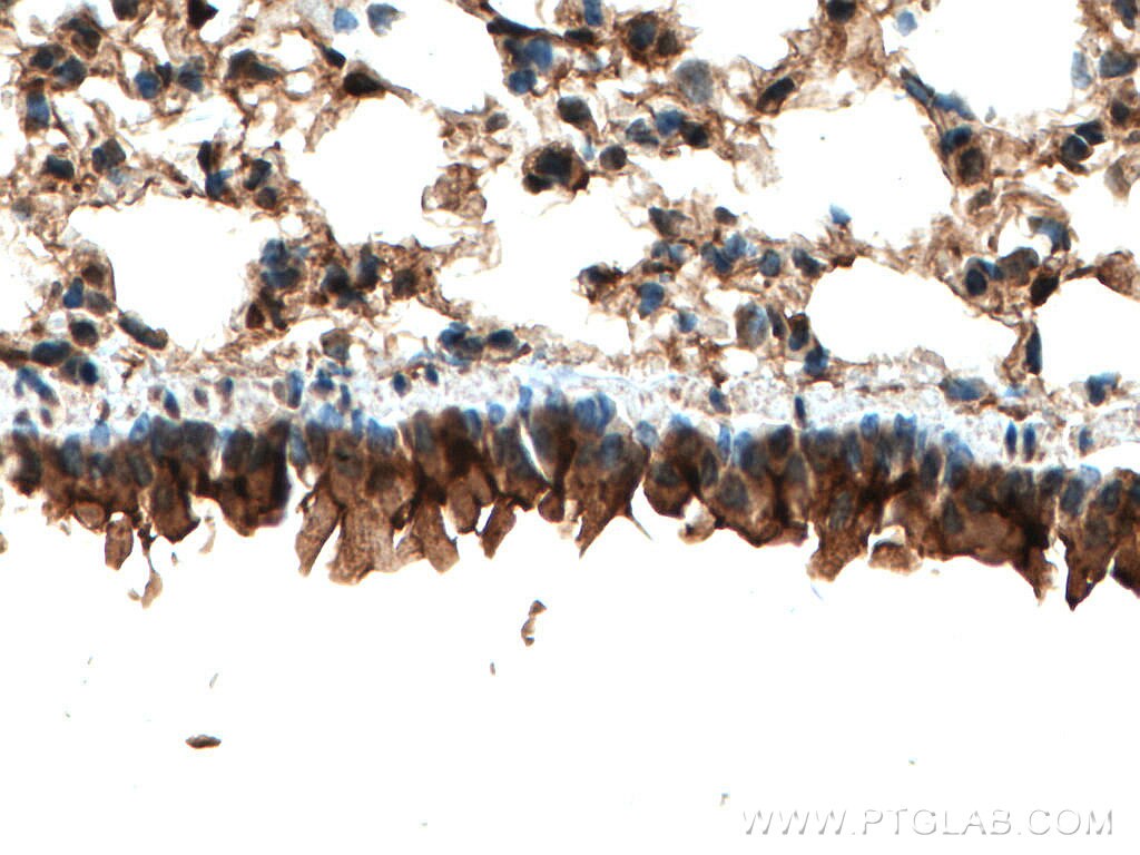 IHC staining of mouse lung using 24899-1-AP