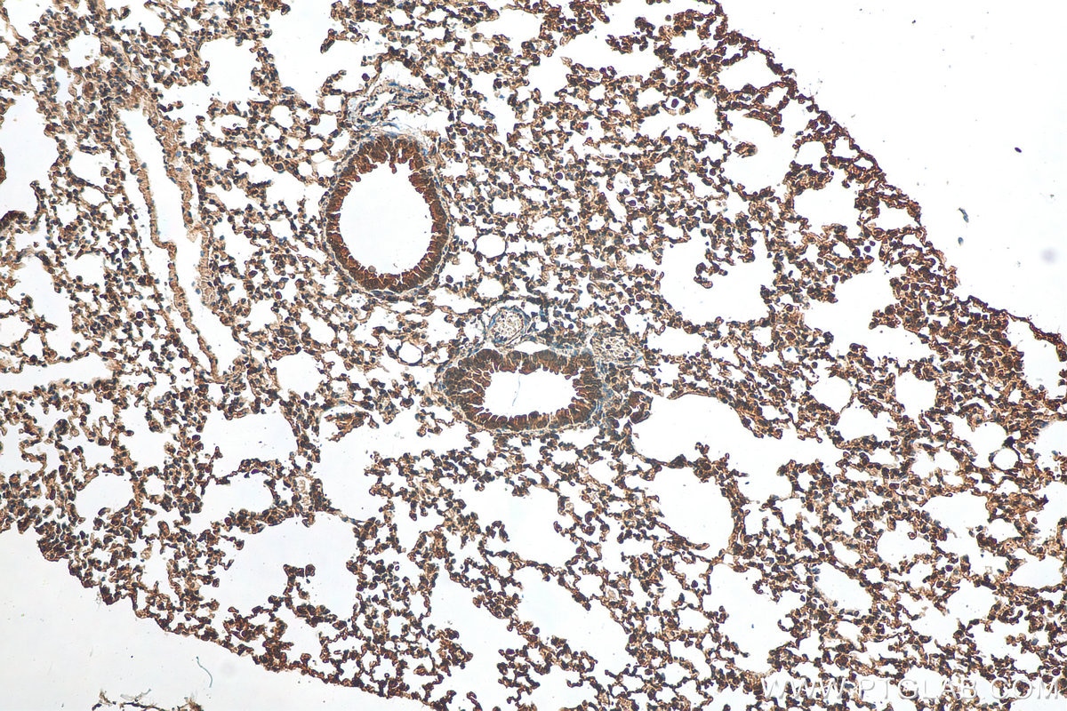Immunohistochemistry (IHC) staining of mouse lung tissue using LRP5 Polyclonal antibody (24899-1-AP)