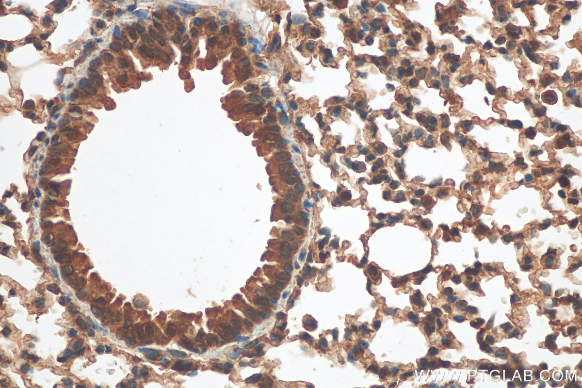 Immunohistochemistry (IHC) staining of mouse lung tissue using LRP5 Polyclonal antibody (24899-1-AP)