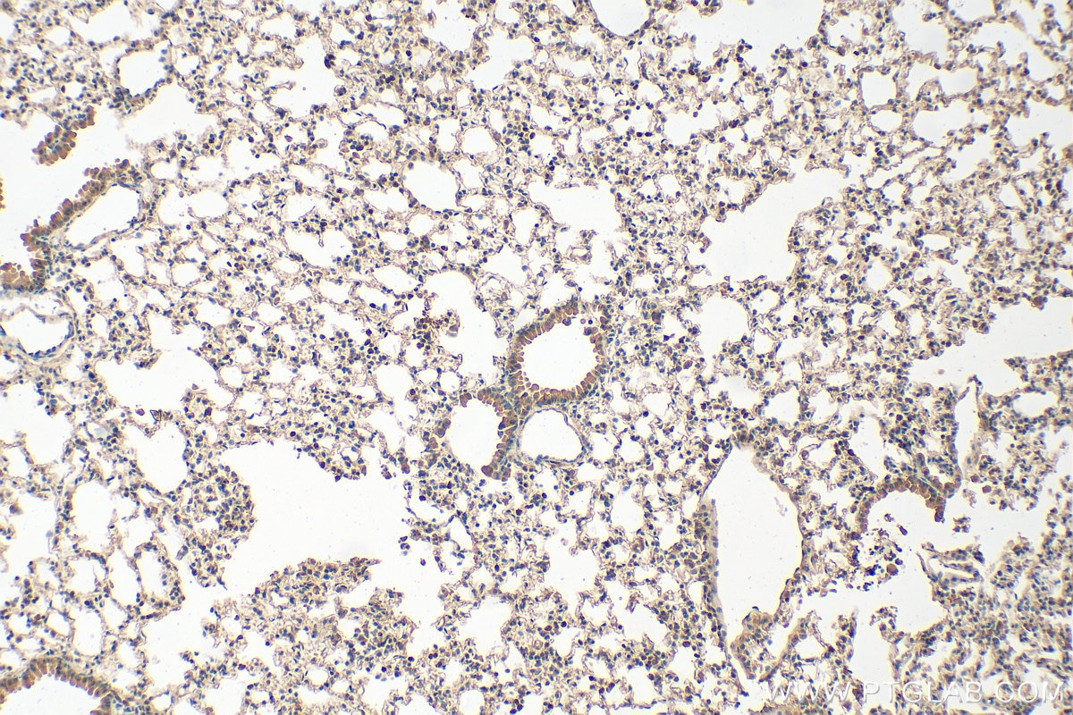 Immunohistochemical analysis of paraffin-embedded mouse lung tissue slide using 24899-1-AP (LRP5 antibody) at dilution of 1:1000 (under 10x lens). Heat mediated antigen retrieval with Tris-EDTA buffer (pH 9.0). Immunohistochemistry (IHC) staining of mouse lung tissue using LRP5 Polyclonal antibody (24899-1-AP)