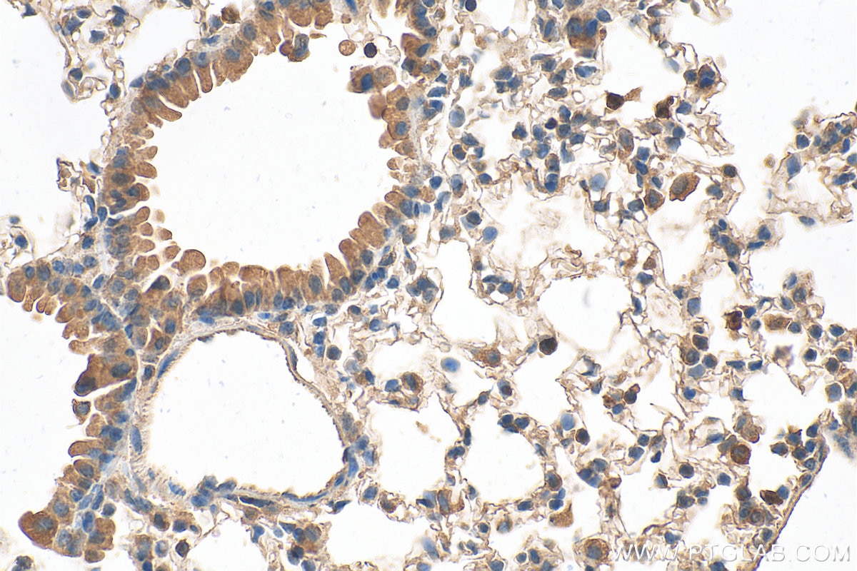 Immunohistochemical analysis of paraffin-embedded mouse lung tissue slide using 24899-1-AP (LRP5 antibody) at dilution of 1:1000 (under 40x lens). Heat mediated antigen retrieval with Tris-EDTA buffer (pH 9.0). Immunohistochemistry (IHC) staining of mouse lung tissue using LRP5 Polyclonal antibody (24899-1-AP)