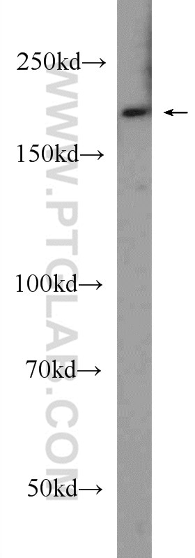Western Blot (WB) analysis of HeLa cells using LRP5 Polyclonal antibody (24899-1-AP)