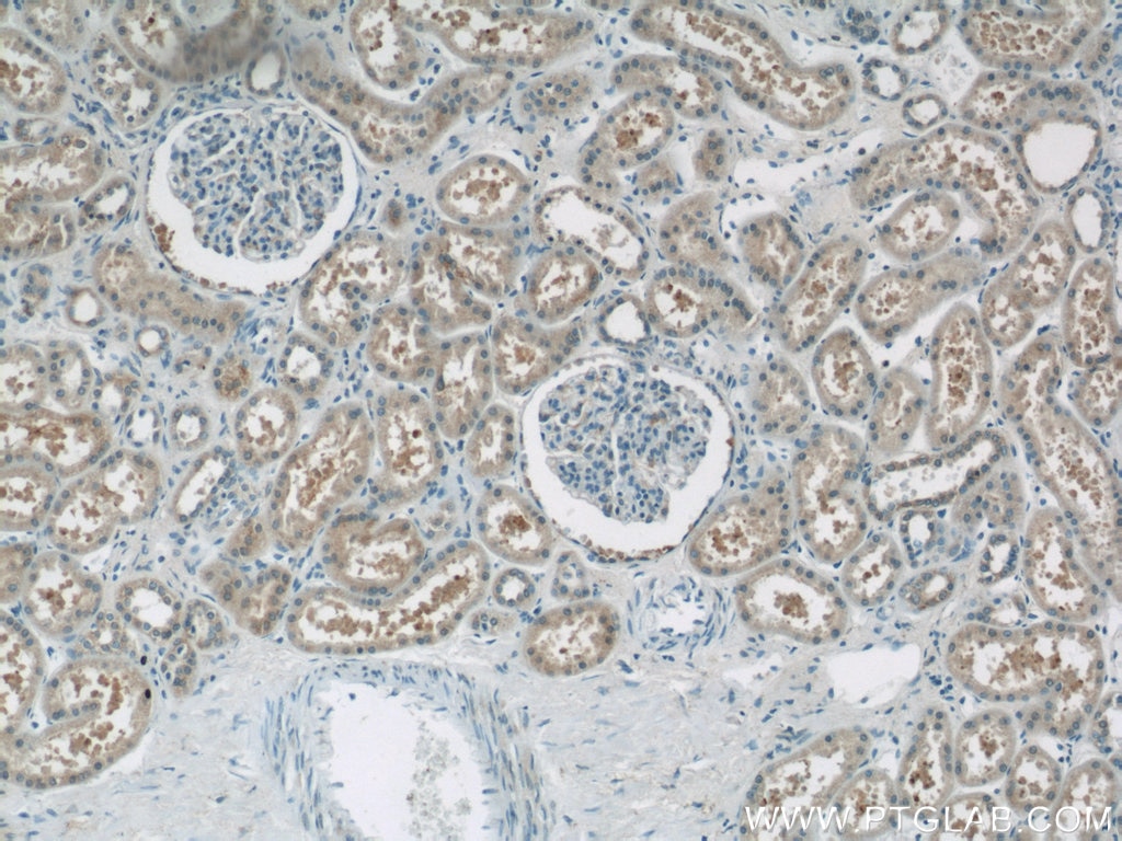 Immunohistochemistry (IHC) staining of human kidney tissue using LRPAP1 Polyclonal antibody (24662-1-AP)