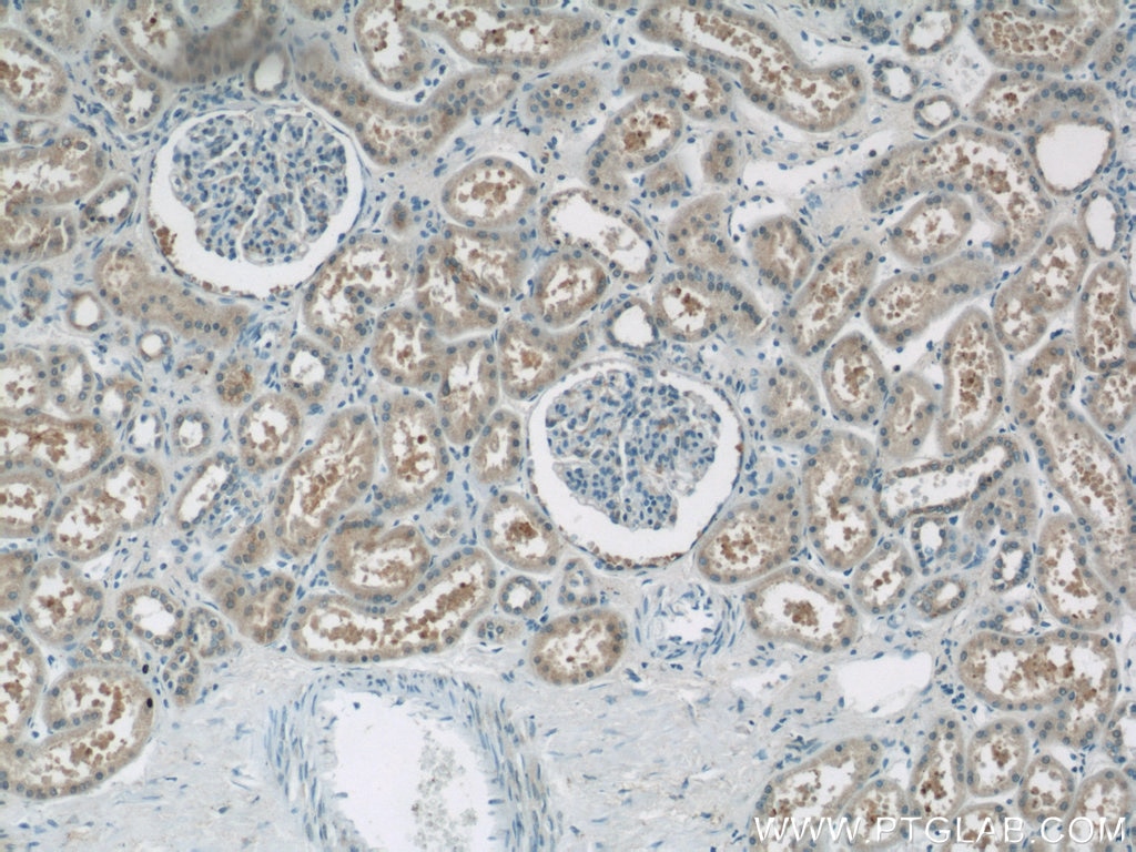 IHC staining of human kidney using 24662-1-AP