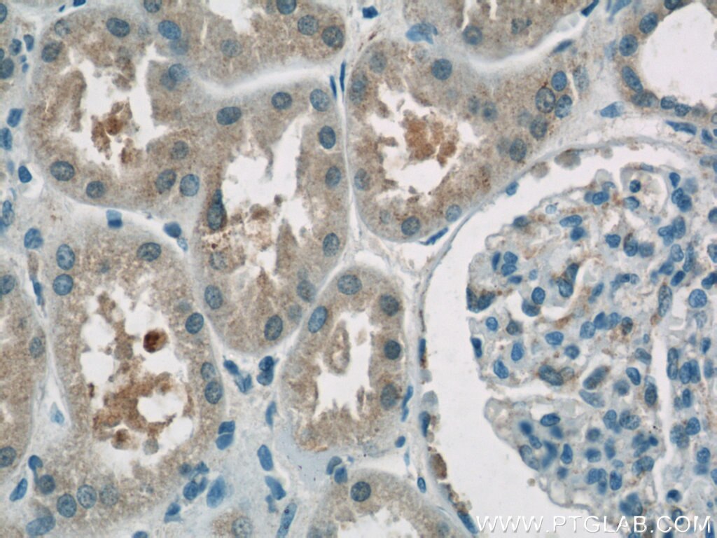 IHC staining of human kidney using 24662-1-AP