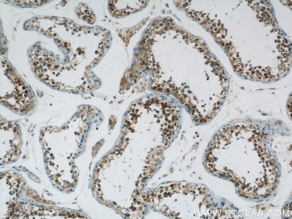 Immunohistochemistry (IHC) staining of human testis tissue using LRPAP1 Polyclonal antibody (24662-1-AP)