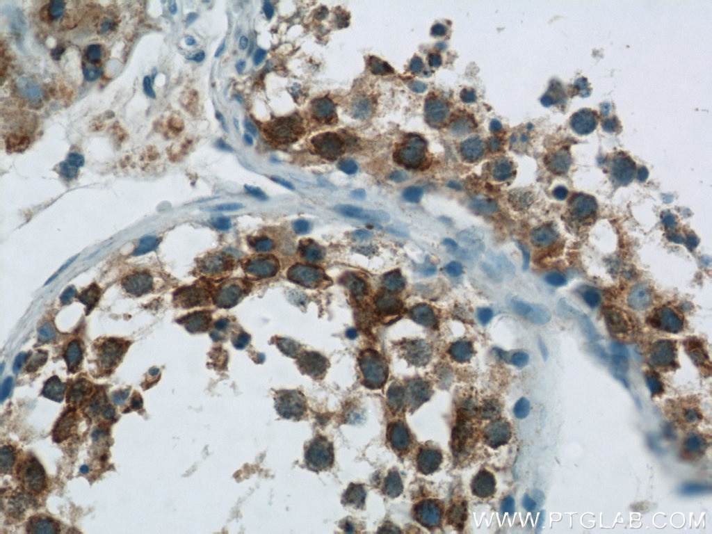 Immunohistochemistry (IHC) staining of human testis tissue using LRPAP1 Polyclonal antibody (24662-1-AP)