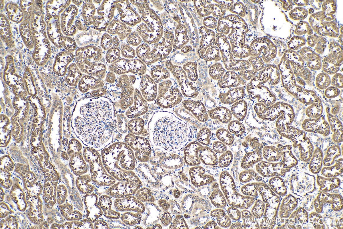 Immunohistochemistry (IHC) staining of human kidney tissue using LRPAP1 Polyclonal antibody (24662-1-AP)