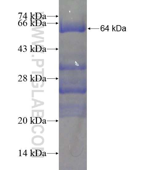 LRPAP1 fusion protein Ag20304 SDS-PAGE