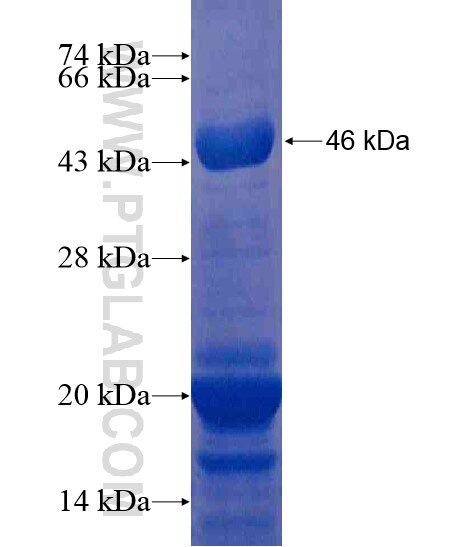 LRPAP1 fusion protein Ag20406 SDS-PAGE