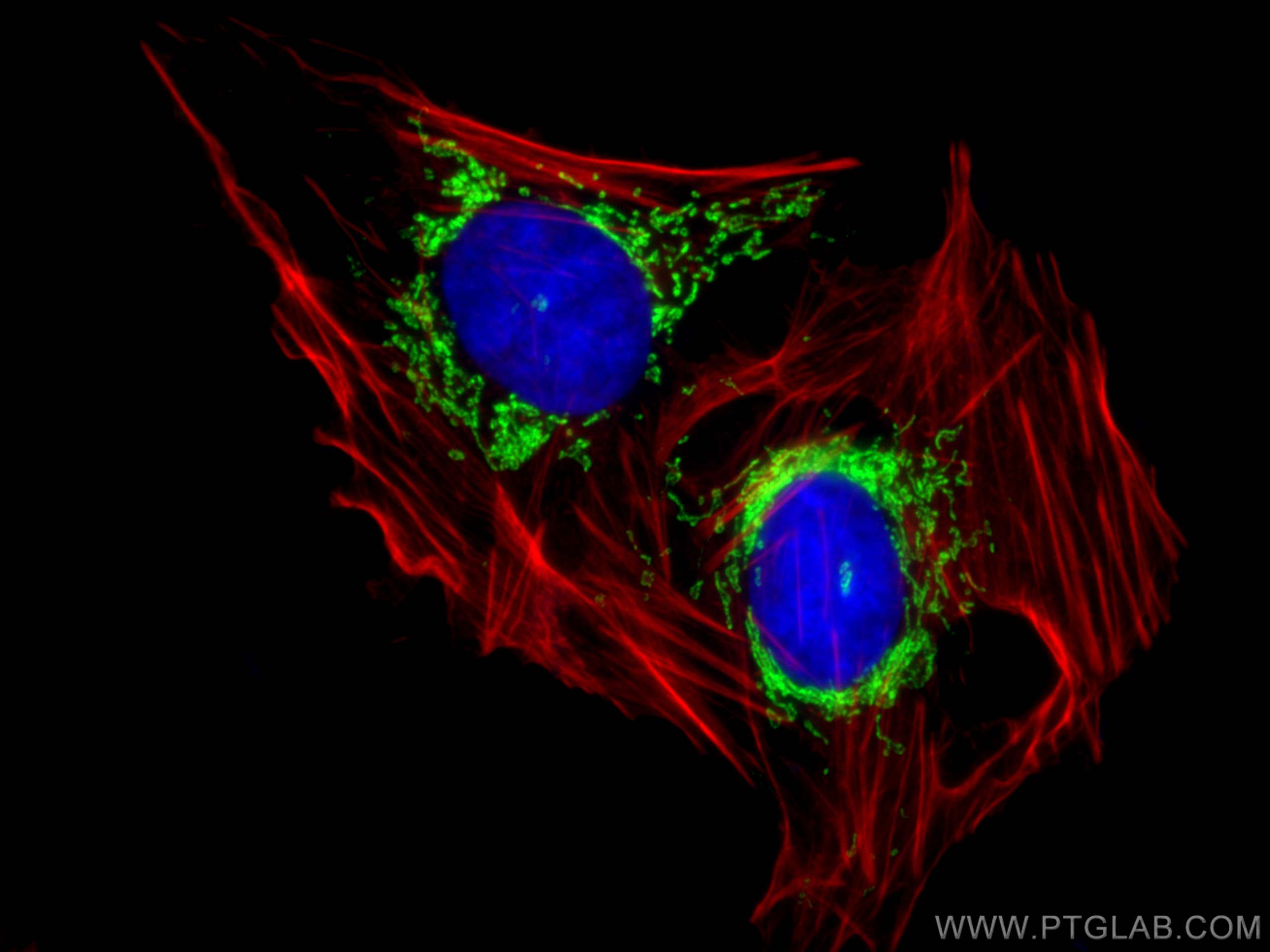 IF Staining of U2OS using 21175-1-AP