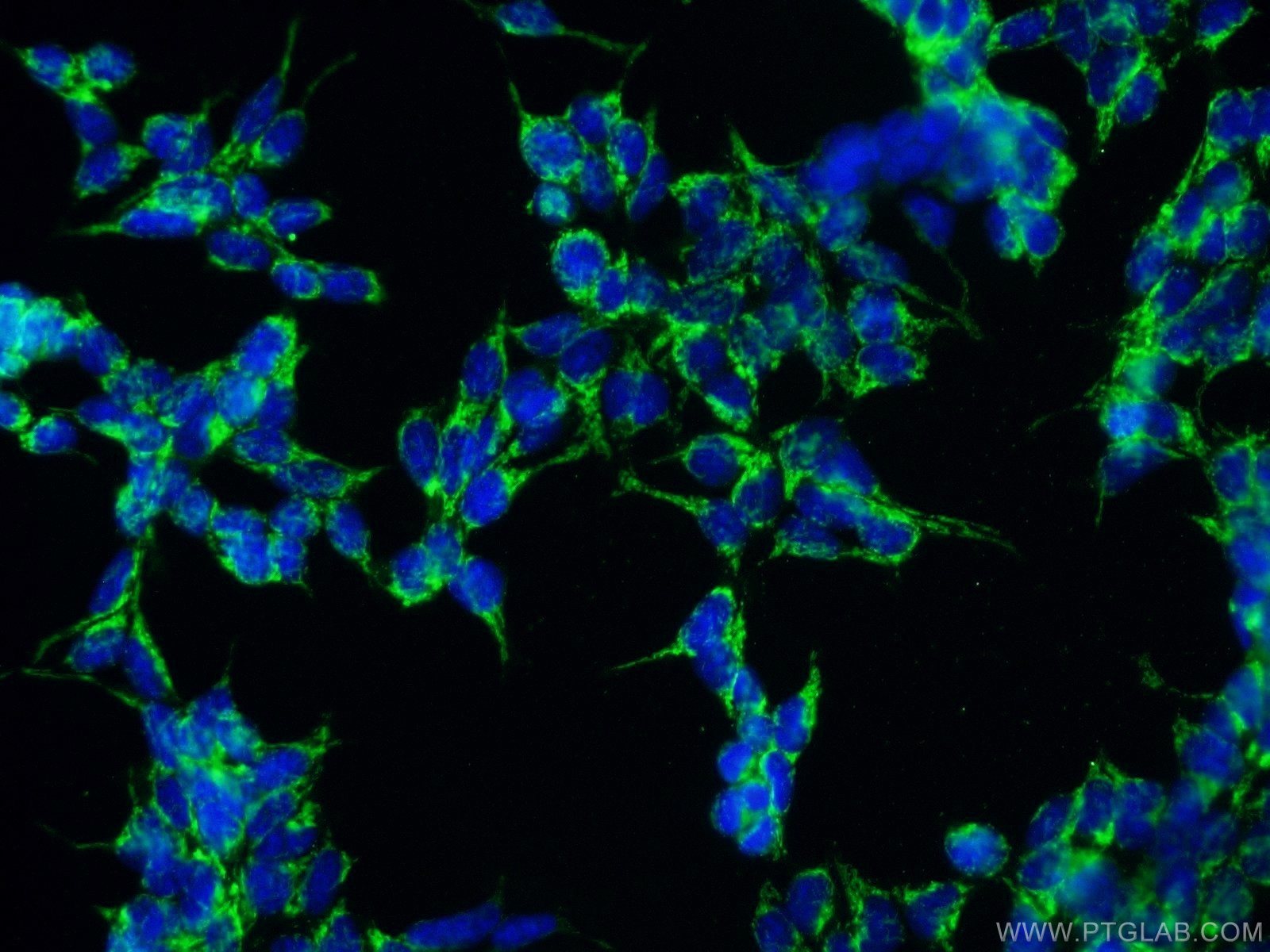 Immunofluorescence (IF) / fluorescent staining of HEK-293 cells using LRPPRC Polyclonal antibody (21175-1-AP)