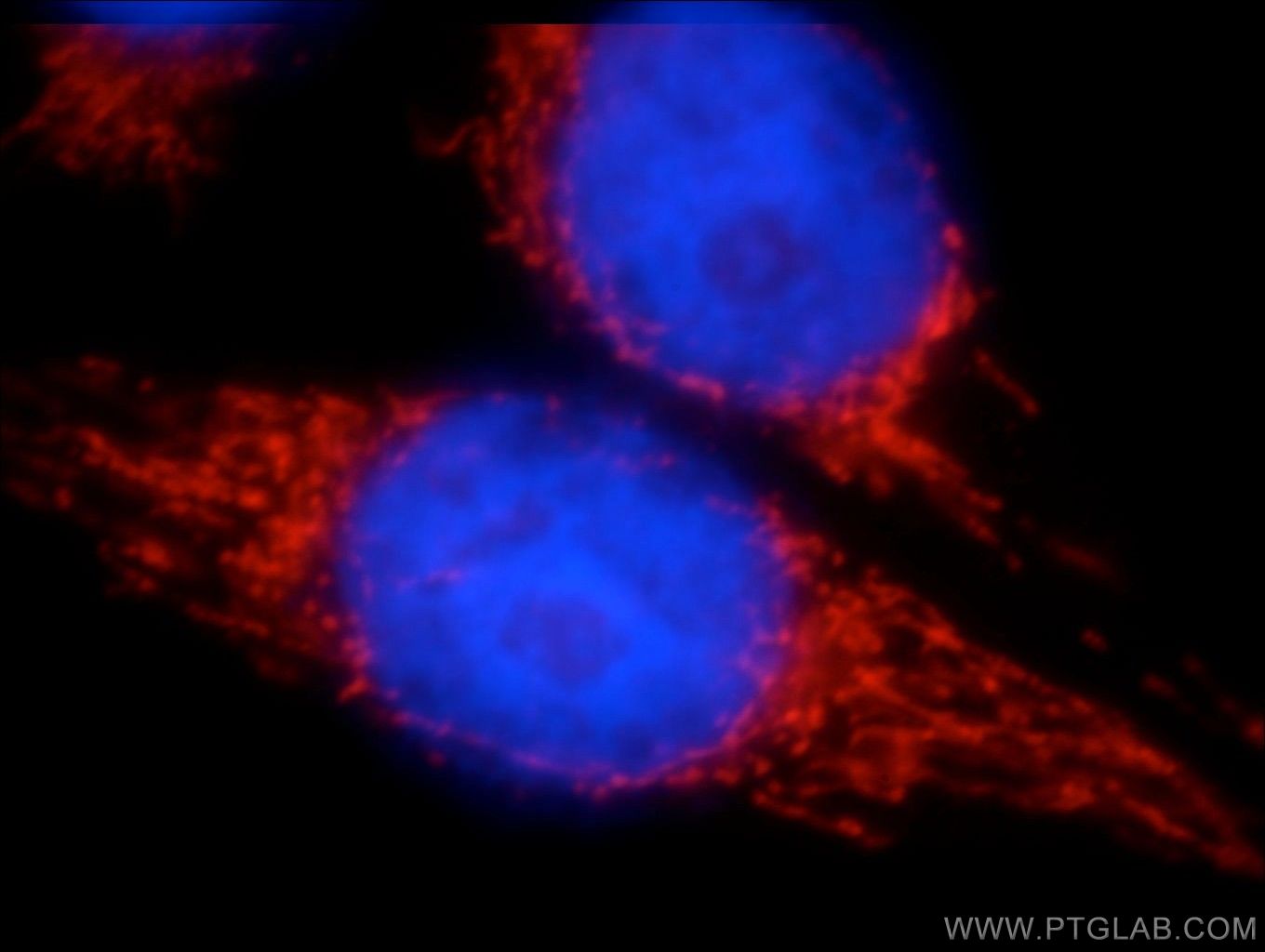 Immunofluorescence (IF) / fluorescent staining of HeLa cells using LRPPRC Polyclonal antibody (21175-1-AP)
